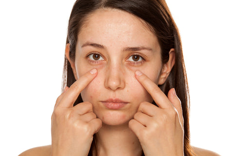 How to Get Rid Of Dark Circles Under The Eyes